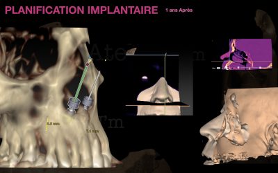 Epithèse-atelier-Jm-Paris